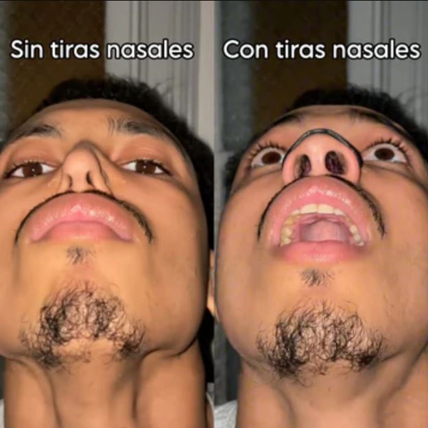 SleepMag™:Respira mejor y duerme profundamente
