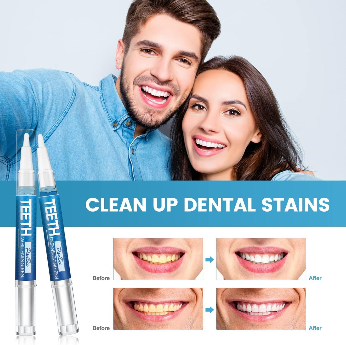 SmilePen Pro™ - Blanqueá Tus Dientes con Tecnología de Odontólogo, Desde Casa