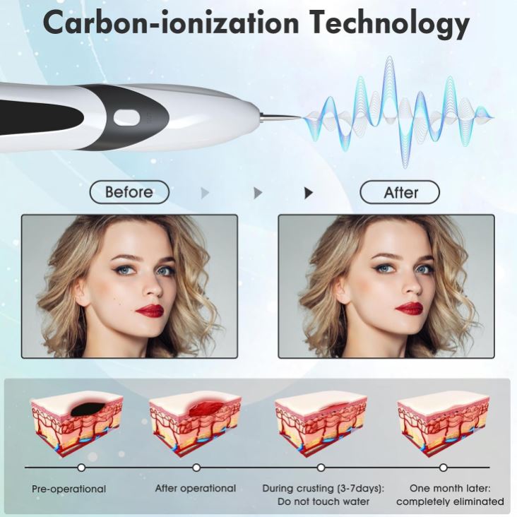 DermoPlasma Pro:🔥 ¡Elimina imperfecciones desde casa como una profesional!